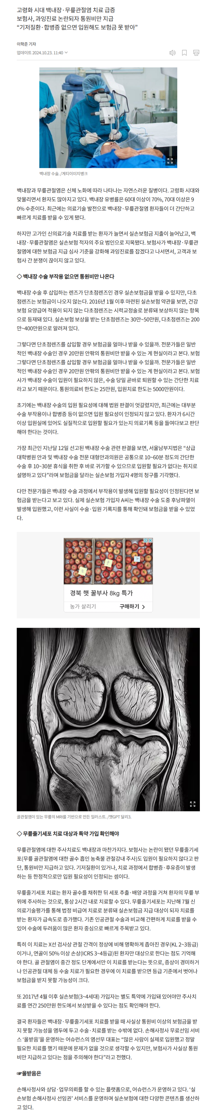 [실손 대백과] 과잉진료 오명 백내장·무릎관절염 입원 인정받으려면 관련 이미지