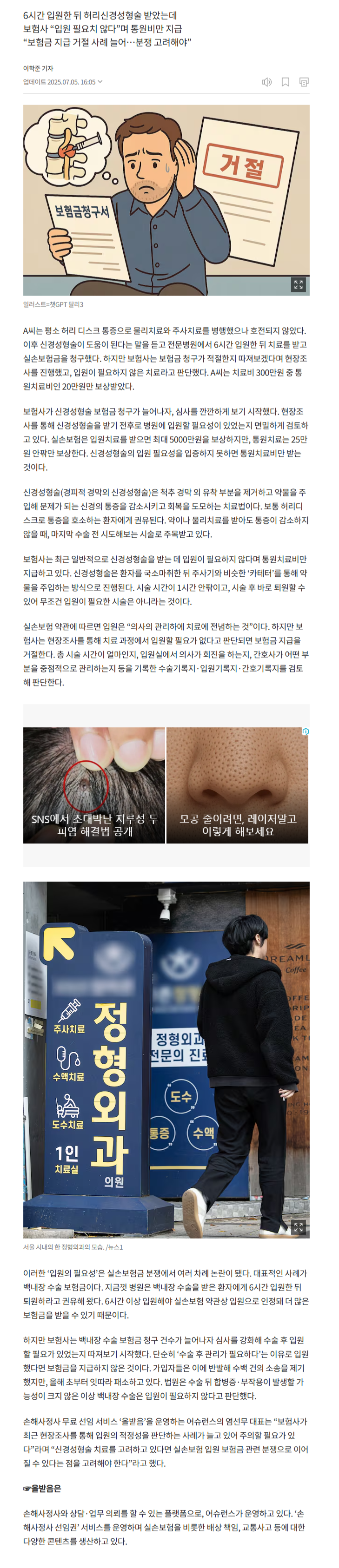 허리신경성형술 보험금 차이 alt=